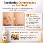 Spray eliminador de verrugas Tag Recede ™| 60 ML