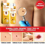 Spray eliminador de verrugas Tag Recede ™| 60 ML